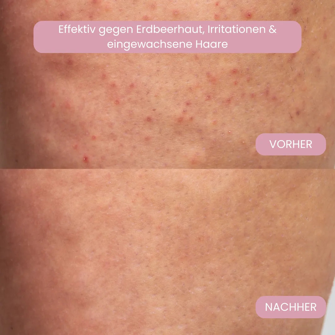 LYVARA PRO - Der #1 Damenrasierer