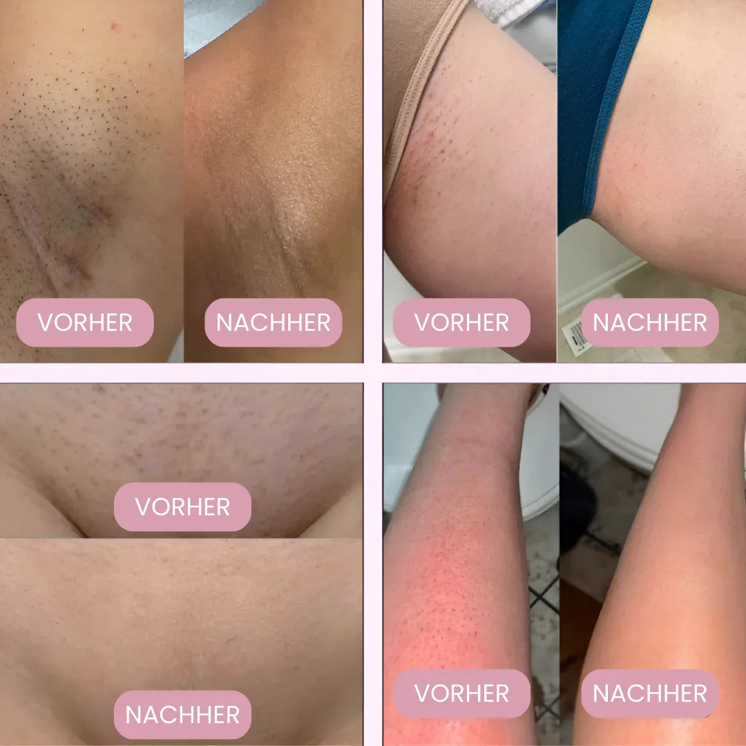 LYVARA PRO - Der #1 Damenrasierer